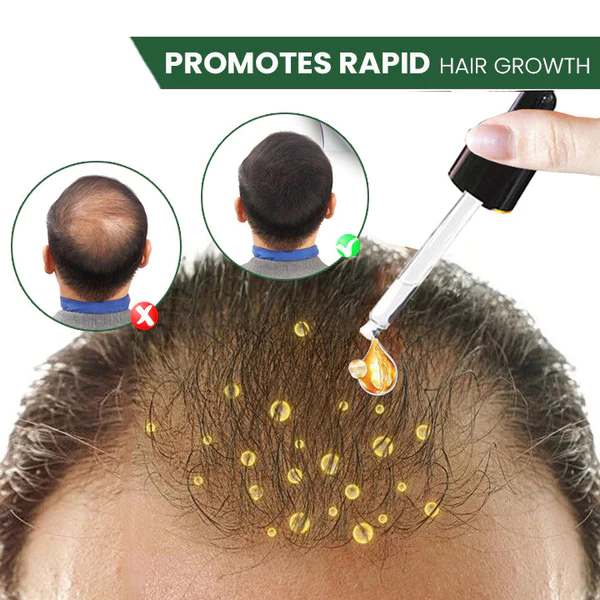 ShougaEssenceHairGrowthOil_Lander07_4f9f4dc4-dd0e-475b-982d-303ace13af59